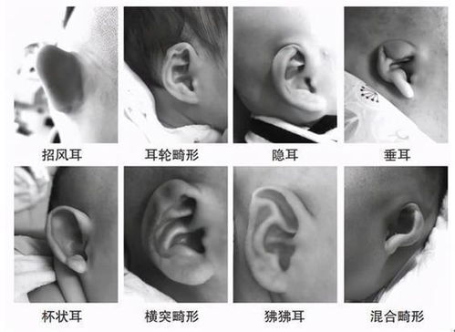 2. 结构性畸形可能导致的功能障碍
