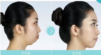 五、 较宽阔方正型与行动派特质
