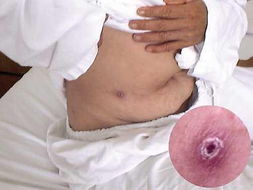 女人梦见虫子咬脚，这究竟预示着什么不祥的征兆呢？