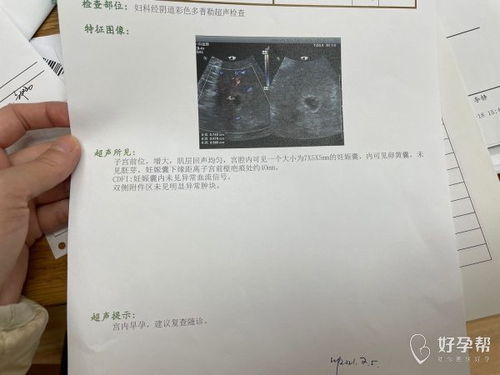 如何为不幸流产的宝宝准确推算出其生辰八字？