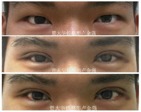 案例分享：真实实体验回溯