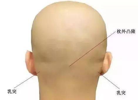 （一）钳穴的形态禁忌与识别要点