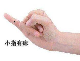 手指痣相的整体解读