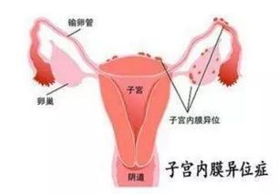 四、 不安与焦虑：心理状态层面的自救方法