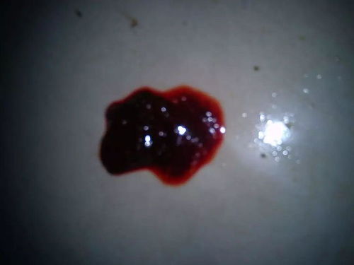 女人梦见沾屎是什么征兆？解梦方法有哪些？