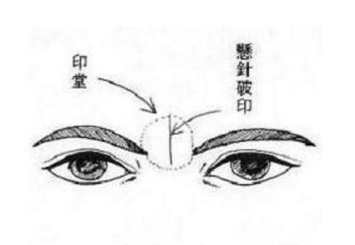 智力与认知架构：额头与印堂的宏观表征