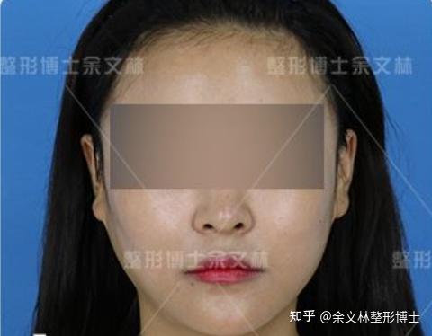 (一) 发型选择——巧妙掩盖视觉较短板