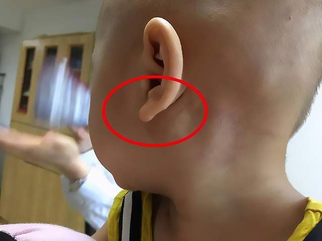 1. 山根挺拔端正：象征坚韧不拔的意志与正派品德