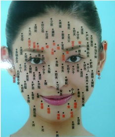 二、 医学角度对太阳穴痣的客观评估