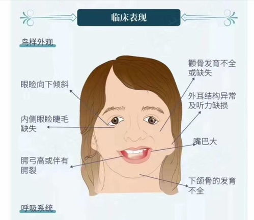 其一：耳廓丰满——智慧与家庭责任感的双重体现