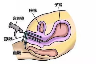 那么呢？怎么了解自己是不是有当前这个问题呢？