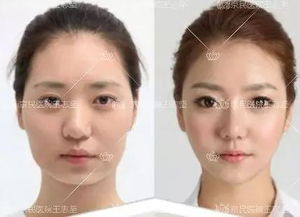 什么是骨骼性脸大面相男性特征及其与生殖健康的关系？