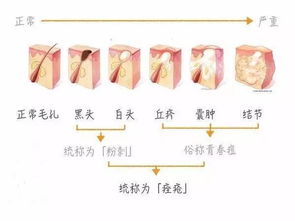 ：从表象窥见本质