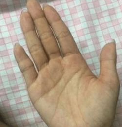 2. 掌心颜色与质地——财富流动与生活艰辛的双向映射