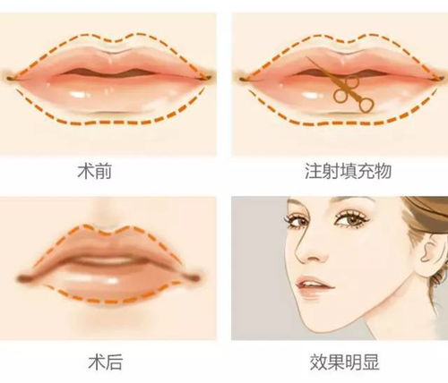 二、 厚实而均衡的上下唇——情感深厚与人格稳健的复合指示器
