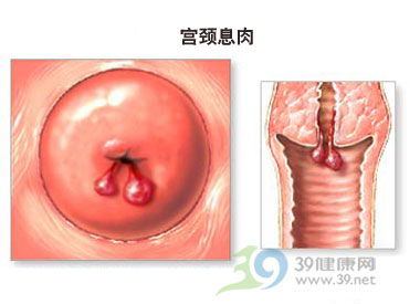 6. 其他因素