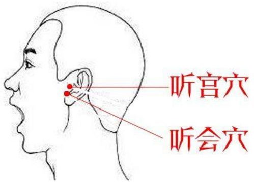 风水不佳是否会引起或加剧耳鸣症状呢？