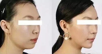 2. 鼻尖颜色变化指示心血管负荷