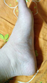 出门右脚崴伤预示着什么吉凶或未来运势？