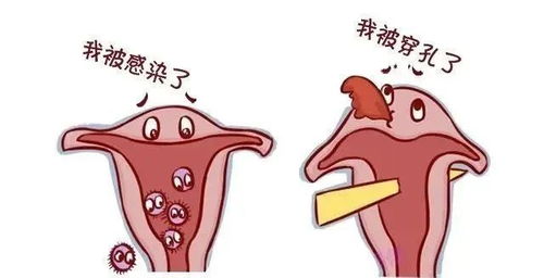 2. 妇科炎症