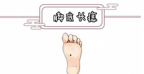 男人脚底长痣生日对应命理运势准确性如何？
