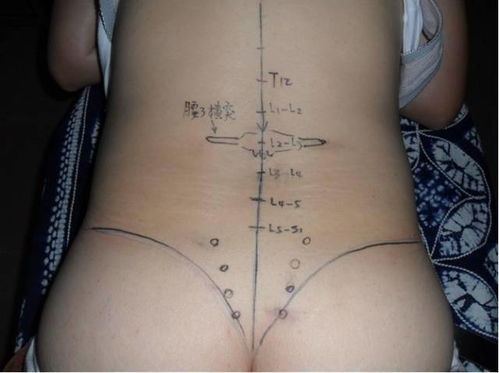 如何精确判断男性婚姻宫的位置？