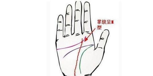 骨头不好=人生完蛋？古人也太会加戏了！