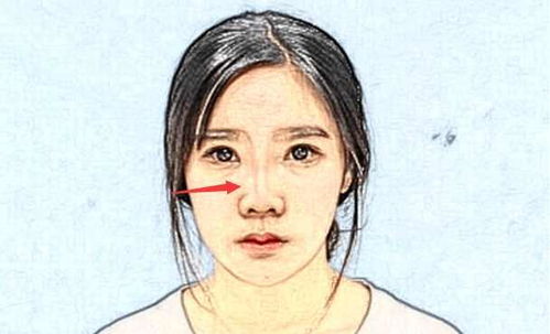 5. 鼻梁及鼻尖
