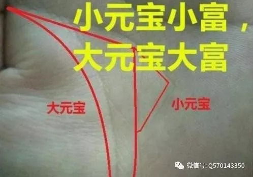 手相大元宝纹断裂，元宝纹图片能看清楚吗？