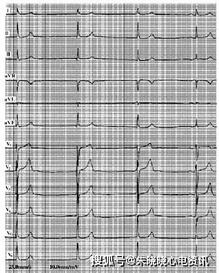 相逐心生之理论基础