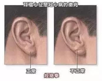3. 耳朵较高于眉毛且耳垂有珠——福禄双收、 情义兼备