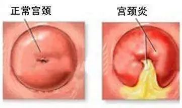 二、痛—身体发出的尖叫声
