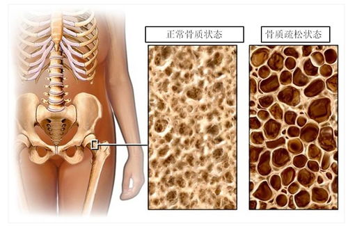 一、  女命富贵命的骨重界定与等级划分