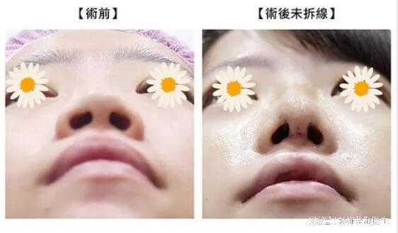 龙鼻的形态学特征与美学解析