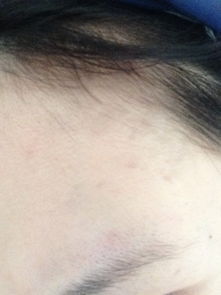 一、 额部痣与情感热度之关联