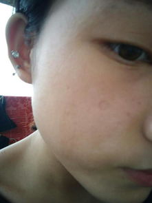 嘴巴上的疤痕和痣：出纳宫及语言表达的影响