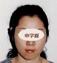 面相脑门竖纹的深度解析：基于传统国学与现代生理学的双重考察