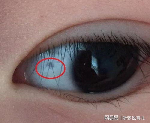 眼头黑点：爱情猎手