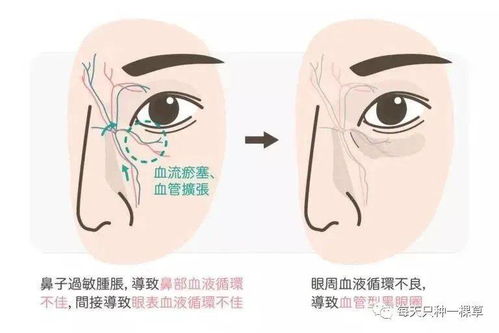 4. 眼睛破相：情感与事业双重打击