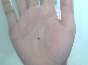 1. 手心有痣：权力欲望与双重标准