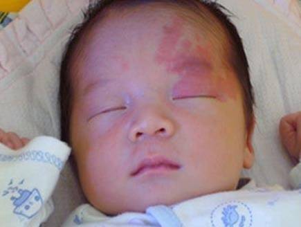 6. 肚脐上方胎标——顺遂平安的人生轨迹