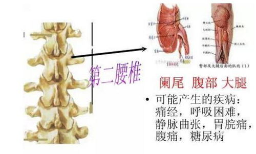 3. 腰椎病症：骨骼问题的潜在危及