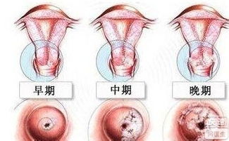 四、中医医治机制：奥秘较深藏