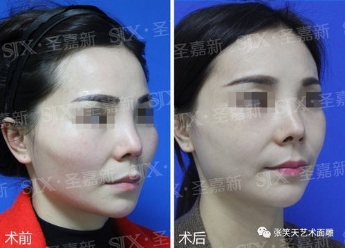 一、 颧骨高之面相意义及文化阐释