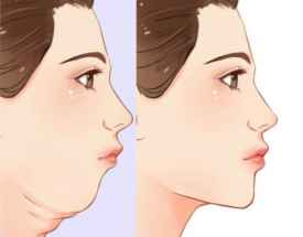 3.2 机遇把握与风险规避