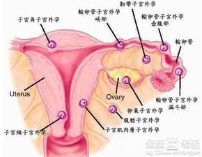 术后恢复那一些事