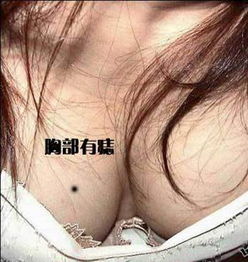 4.1 呼吸系统疾病的发病率及影响