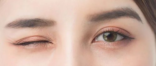 右眼皮跳动的医学解释