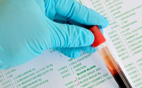 血型分布与财富地理格局之初步观察