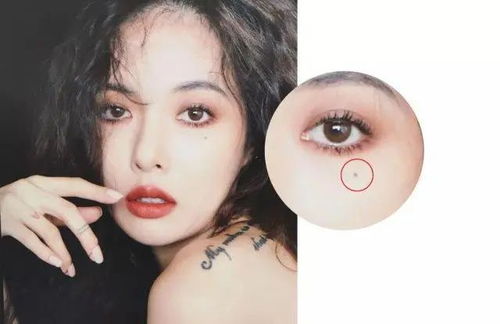 后天长泪痣对命运有影响吗？